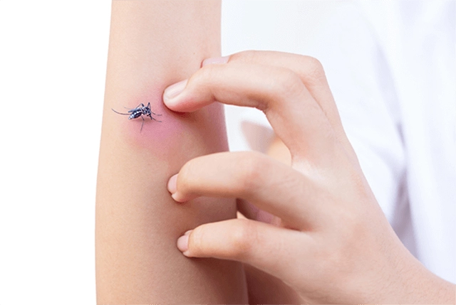 Sivrisinek Isırıklarının Zararlarını Biliyor Muydunuz?
