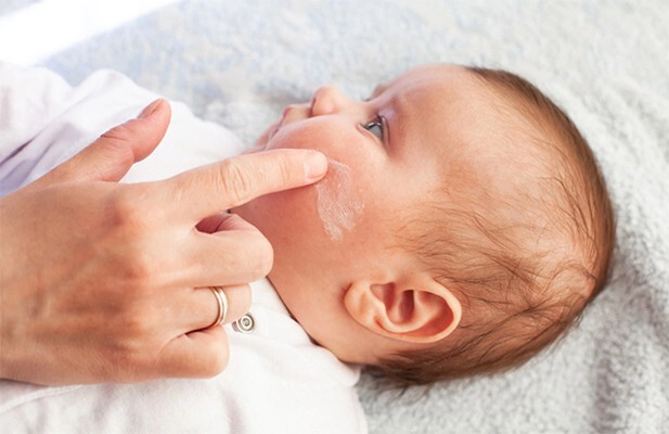 Bebeklerde Egzama (Atopik Dermatit) Belirtileri